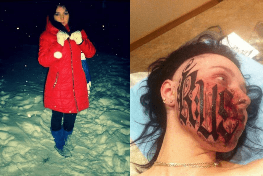 Russian girl got her boyfriend's name tattooed on her face. Before and after